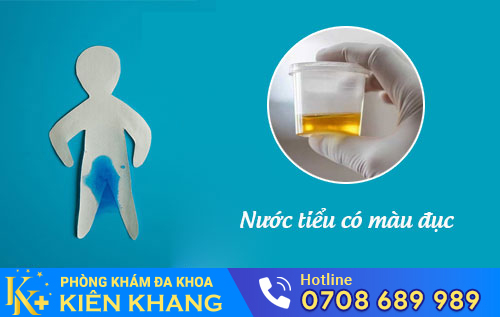 Nước Tiểu Đục – Chạy Ngay Đi Viện Khi Còn Kịp
