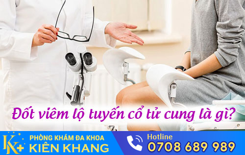 Những Thông Tin Về Đốt Viêm Lộ Tuyến Cổ Tử Cung