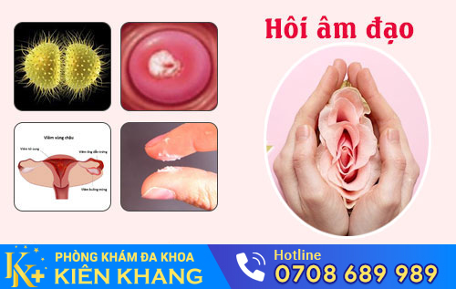Hiện Tượng Hôi Âm Đạo Ở Nữ Giới Là Dấu Hiệu Của Bệnh Gì?