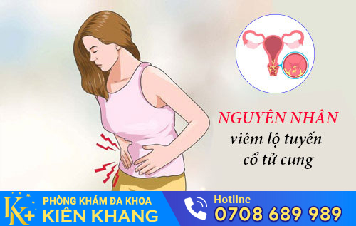 Nguyên Nhân Viêm Lộ Tuyến Cổ Tử Cung Là Gì?