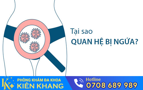 Quan Hệ Bị Ngứa, Tưởng Nhẹ Mà Không Hề Nhẹ