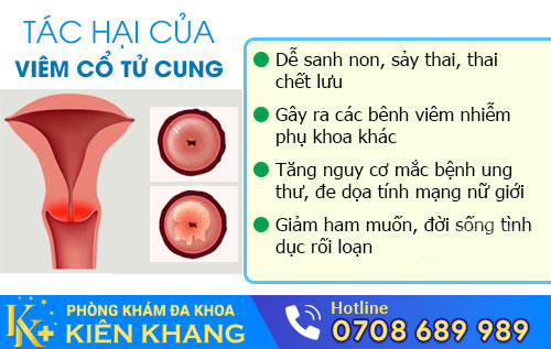 Cảnh Báo: Đừng Nên Xem Thường Viêm Cổ Tử Cung