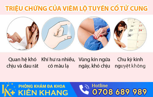 Phương Pháp Dao LEEP Trị Viêm Lộ Tuyến