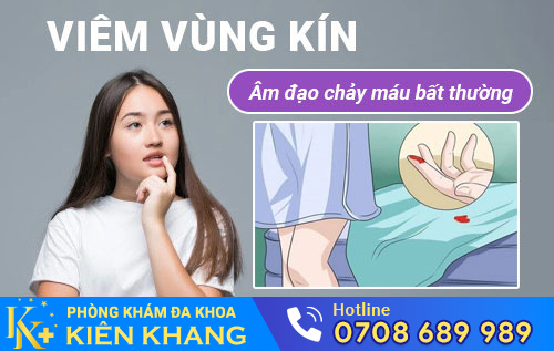 Viêm Vùng Kín – Nỗi Khổ Tâm Của Chị Em Phụ Nữ