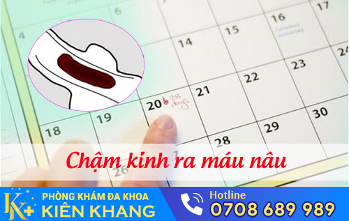 Chậm Kinh Ra Máu Nâu Là Bị Làm Sao?