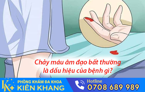 Chảy Máu Âm Đạo Bất Thường Là Dấu Hiệu Của Bệnh Gì?