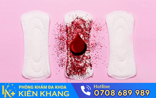 Nhiều Bệnh Phụ Khoa Nguy Hiểm Qua Dấu Hiệu Máu Kinh Vón Cục