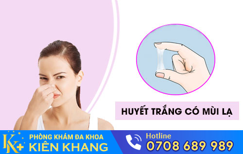 Làm Rõ Nguyên Nhân Khiến Huyết Trắng Có Mùi Lạ