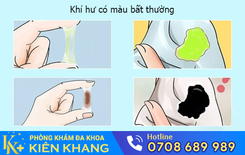 Bắt Bệnh Phụ Khoa Qua Màu Sắc Bất Thường Của Khí Hư
