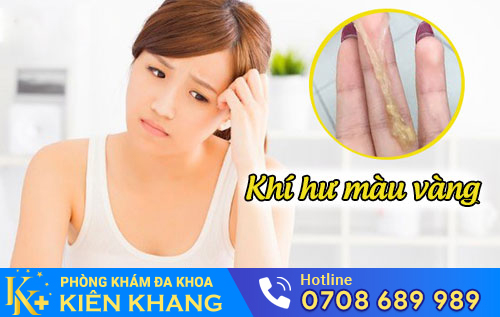 Khí Hư Màu Vàng Là Dấu Hiệu Bệnh Gì? Phương Pháp Hỗ Trợ Điều Trị?