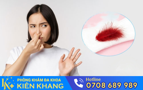 Kinh Nguyệt Có Mùi Hôi – Điều Gì Khiến Chị Em Lo Ngại?