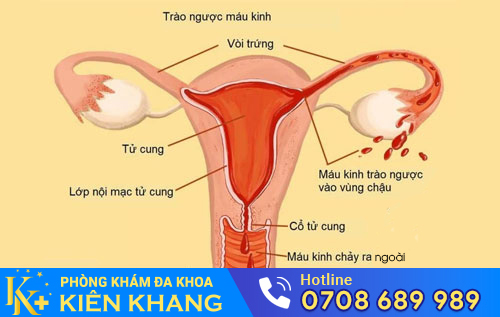 Nguyên Nhân Khiến Kinh Nguyệt Không Đều Và Cách Hỗ Trợ Điều Trị Hiệu Quả