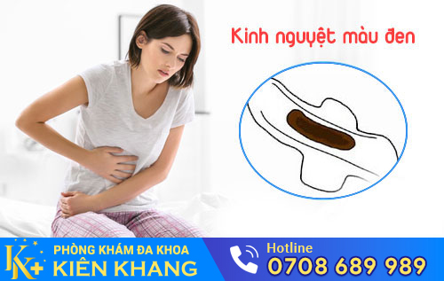 Kinh Nguyệt Màu Đen Là Bị Bệnh Gì? Có Nguy Hiểm Không