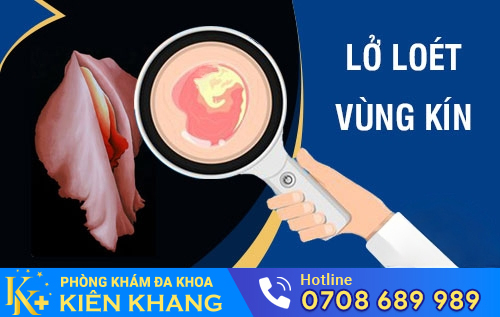 Lở Loét Vùng Kín Là Bệnh Gì?