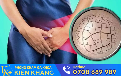 Đau Vùng Kín Là Dấu Hiệu Của Bệnh Gì?