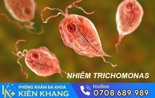 Bị Nhiễm Trichomonas – Đừng Nên Chủ Quan!