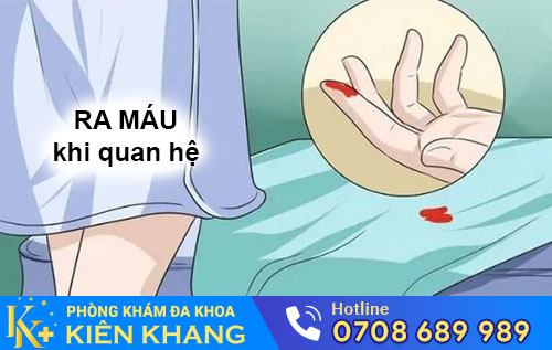 Chị Em Hãy Coi Chừng Nếu Bị Ra Máu Khi Quan Hệ