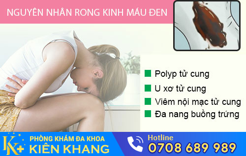 Rong Kinh Máu Đen – Cẩn Thận Bệnh Nguy Hiểm
