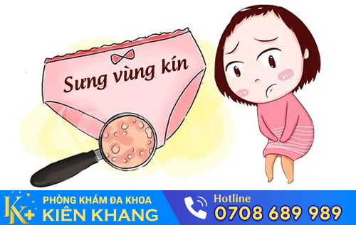 Sưng Vùng Kín Là Bệnh Gì? Có Nguy Hiểm Không?