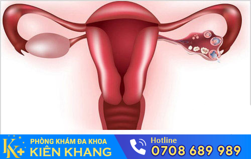 Tất Tần Tật Những Kiến Thức Mà Chị Em Nên Biết Về Bệnh Phụ Khoa