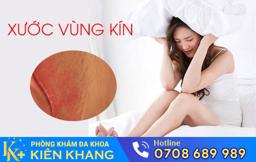 Xước Vùng Kín, Chị Em Không Thể Xem Thường